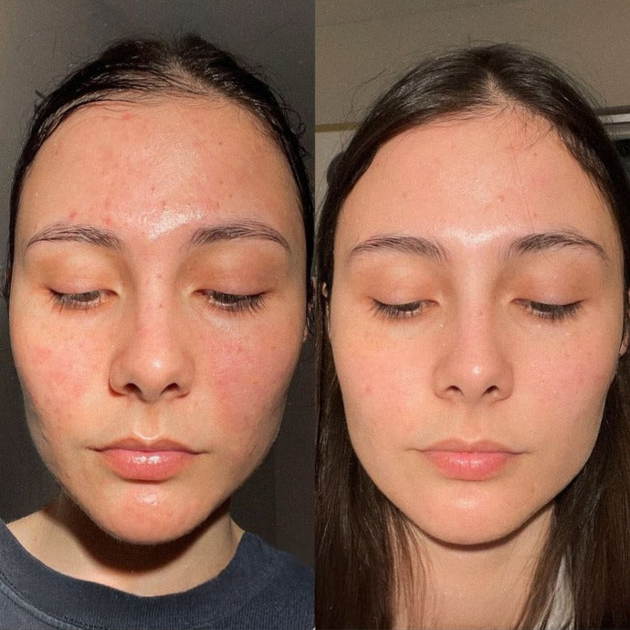 The Perfector brightening serum to reduce pigmentation and even out skin tone