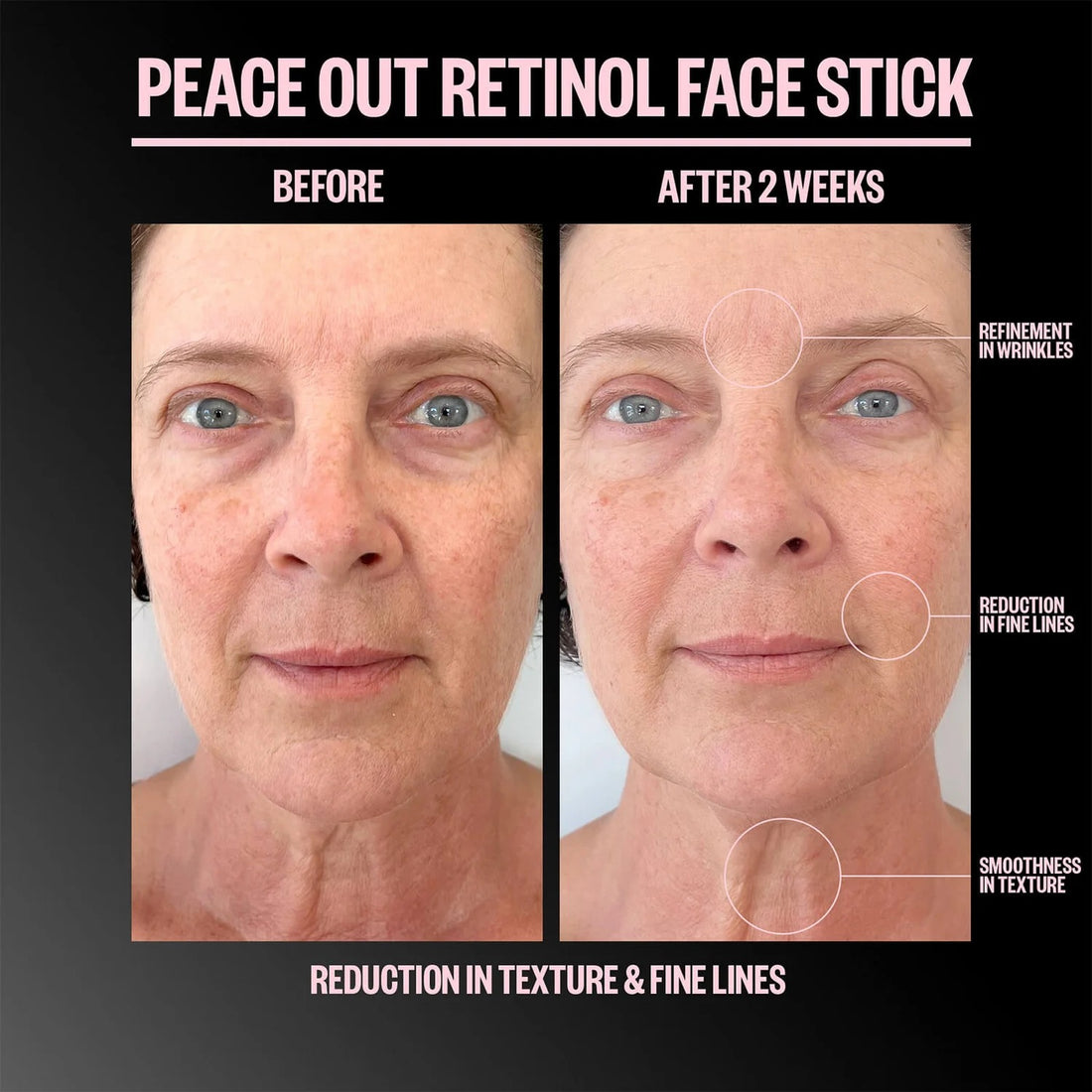 Peace Out Retinol Face Stick 8g