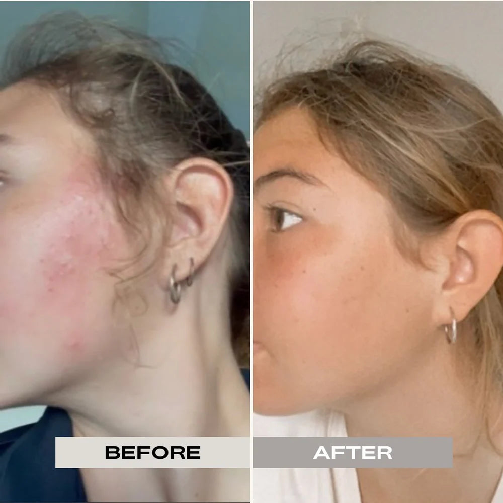 French Green Clay Mask Refill — purifying and calming natural face mask with matcha and olive leaf