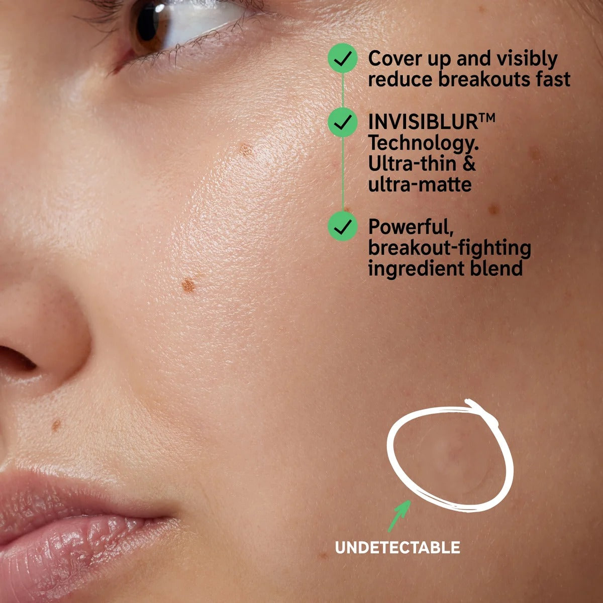 The INKEY List Hydrocolloid Invisible Pimple Patches