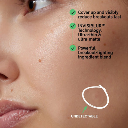 The INKEY List Hydrocolloid Invisible Pimple Patches